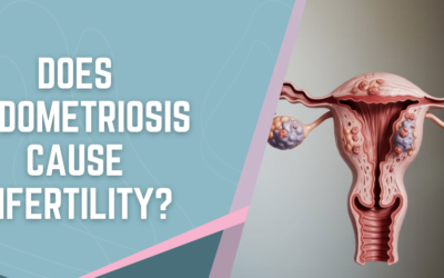 Does Endometriosis Cause Infertility?