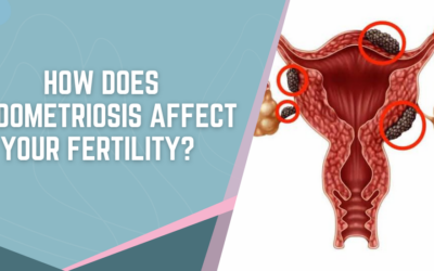 How Does Endometriosis Affect Your Fertility?